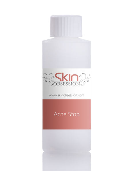 Acne Treatment Solution - Acne Stop 4 fl oz Bottle - Skin Obsession